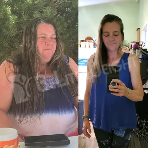 Kimberly W - 1 Year Update*